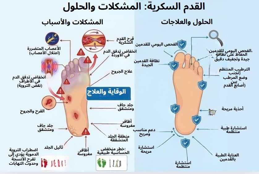 القدم-السكري-بطنجة | الدكتور الادريسي رضوان